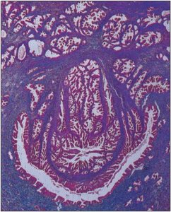 Histology of the prostate gland
