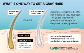 Diagram explaining the loss of melanocytes and gray hair formation