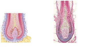 Longitudinal section of hair follicle showing matrix and papilla