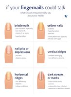 Infographic showing nail changes and their possible health implications