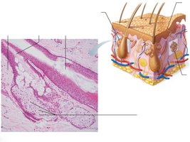 Micrograph of sebaceous gland