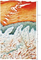 Light micrograph of the dermis showing papillary and reticular layers