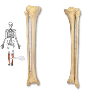 Tibia and fibula with anatomical orientation