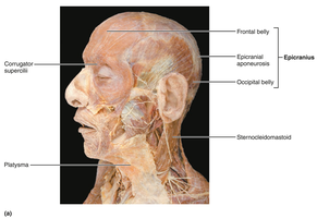 Lateral view of muscles of the scalp, face, and neck (cadaver)