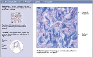 Dense irregular connective tissue: structure and photomicrograph