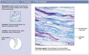 Fibrocartilage: structure and photomicrograph
