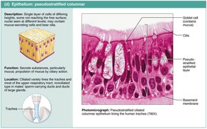 Pseudostratified columnar epithelium: structure and photomicrograph