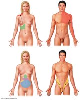 Referred pain regions