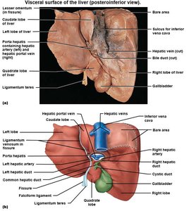 Visceral surface of the liver with labeled ligaments and fissures
