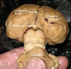 Pineal gland location in the brain