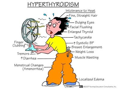 Symptoms of hyperthyroidism