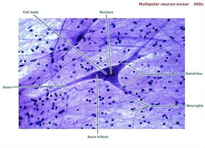 Multipolar neuron smear, labeled