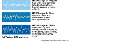 Progression of sleep stages throughout the night