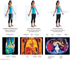 Planes of the body with MRI scans
