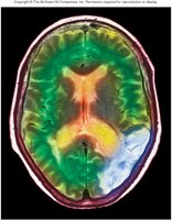 Radiographic anatomy: Brain MRI