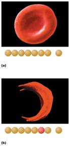 Normal vs. sickle cell erythrocyte