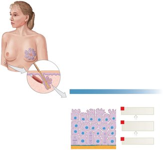 Holocrine secretion mechanism