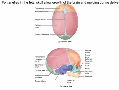 Fontanelles in the fetal skull, superior and lateral views