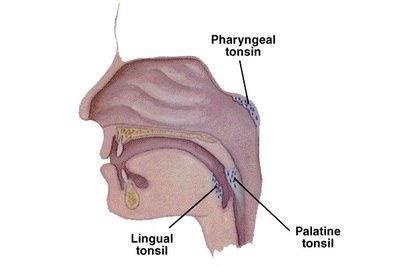 Diagram of the pharyngeal, palatine, and lingual tonsils