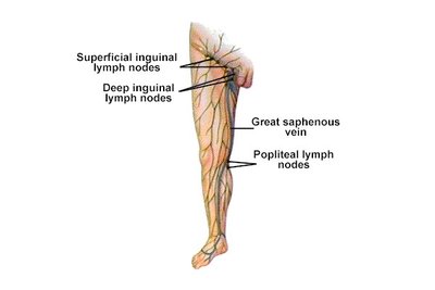 Diagram of leg and inguinal lymph nodes