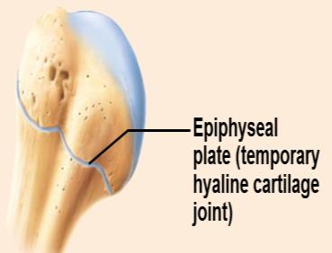 Epiphyseal plate as synchondrosis