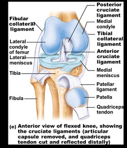 Knee injury (unhappy triad)