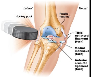 Anterior view of shoulder joint capsule