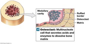 Osteoclasts