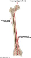 Distribution of forces on a long bone