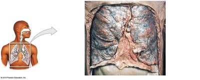 Anterior view of the lungs showing lobes and fissures