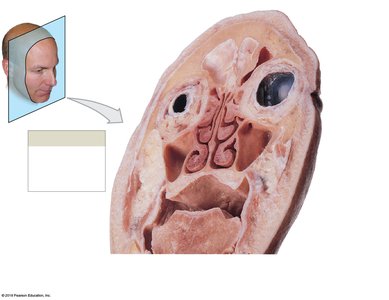 Frontal section of the head showing nasal meatuses and sinuses