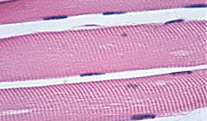Skeletal muscle tissue histology example