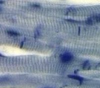 Cardiac muscle tissue histology example