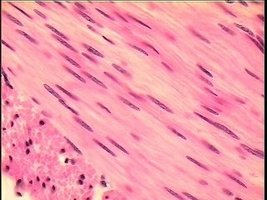 Smooth muscle tissue histology example