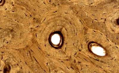 Compact bone under microscope
