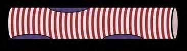 Skeletal muscle fiber