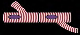 Cardiac muscle fiber with intercalated disc