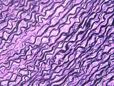 Elastic connective tissue under microscope