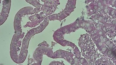 Simple Columnar Epithelium under microscope