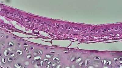 Pseudostratified Columnar Epithelium under microscope