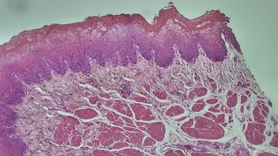 Stratified Squamous Epithelium under microscope