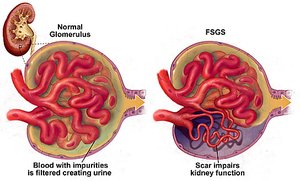 Anatomy & Physiology II Urinary System Study Guide | Notes