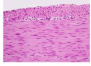 Smooth muscle tissue under microscope