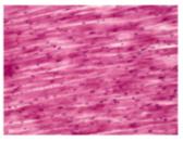 Cardiac muscle tissue under microscope