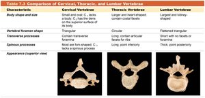 Lumbar vertebrae