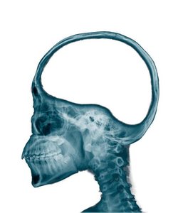 lateral x-ray of head