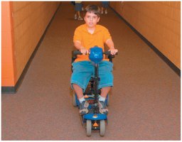 Child with muscular dystrophy