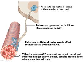 Polio attacks motor neurons