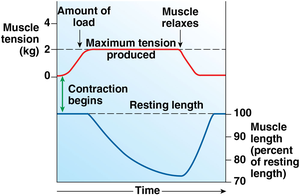 Concentric contraction: muscle shortens