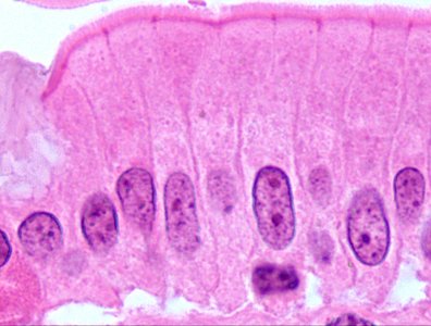 Histology slide stained with hematoxylin and eosin
